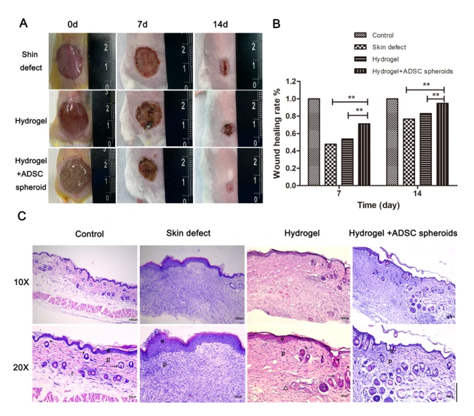 استفاده از هیدروژل هیالورونیک اسید دوپامین متاکریله شده، به عنوان یک حامل موثر برای سلول‌های بنیادی در درمان بازسازی پوست 